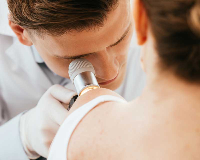 Dermoscopy and skin screening exams